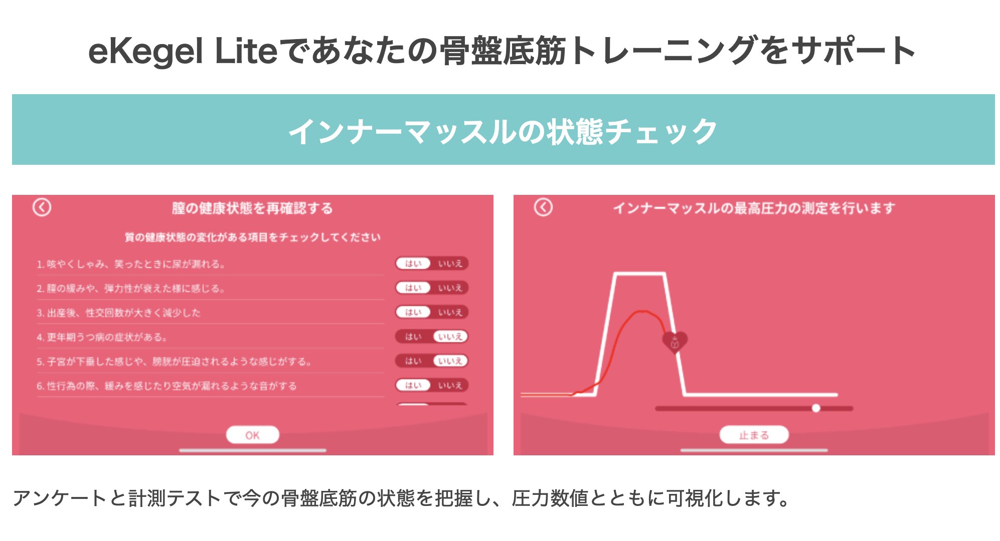 eKegel Liteの画像