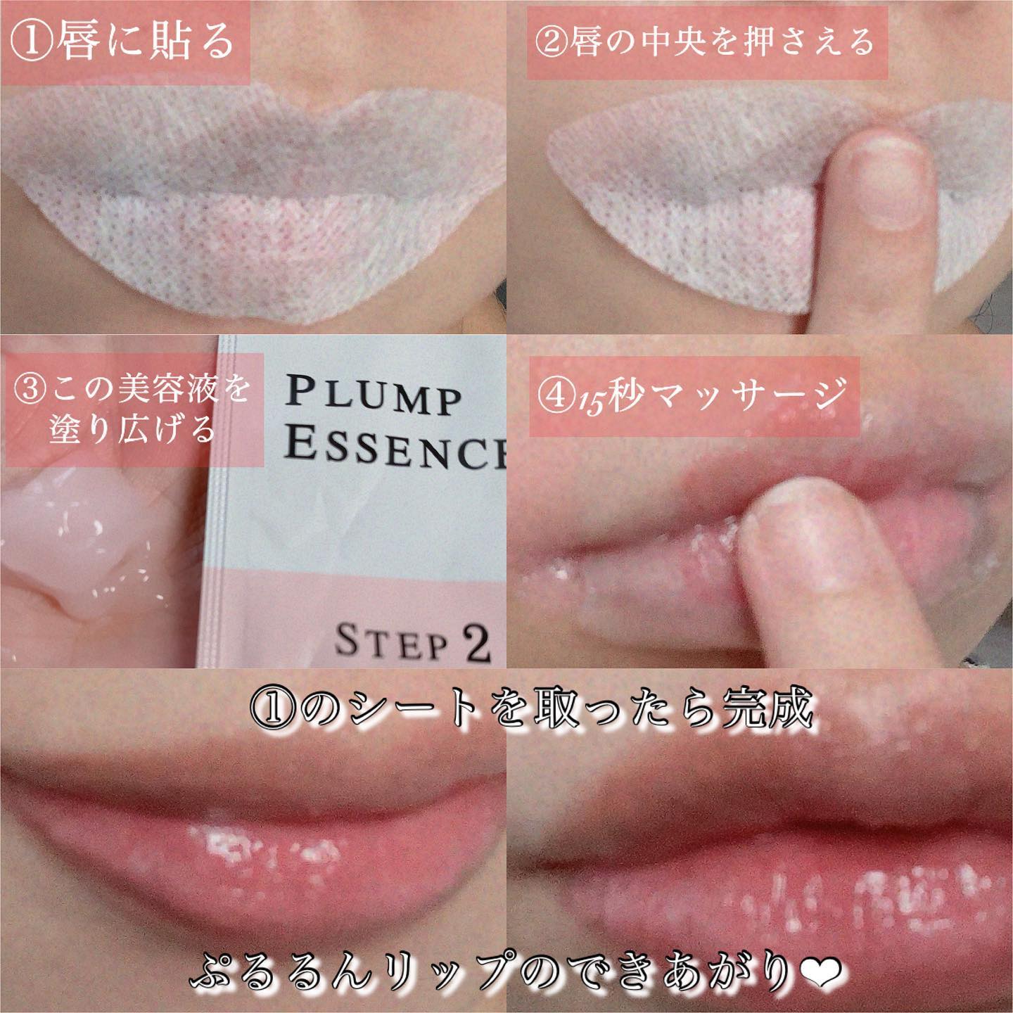 【送料無料】リップショット 唇用マイクロニードル画像